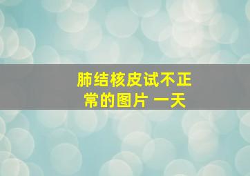 肺结核皮试不正常的图片 一天